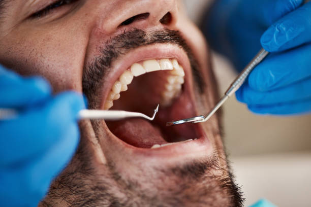 Best Emergency Dental Care for Trauma or Injury in St George, KS